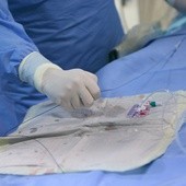 Pierwszy w Polsce jednoczesny przeszczep serca i wątroby