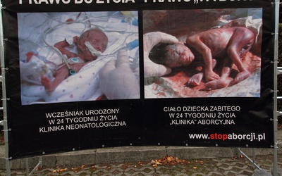 Cenzura ws. handlu organami abortowanych dzieci